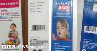 14 Anak India Meninggal Keracunan Obat Batuk Tercemar Metanol